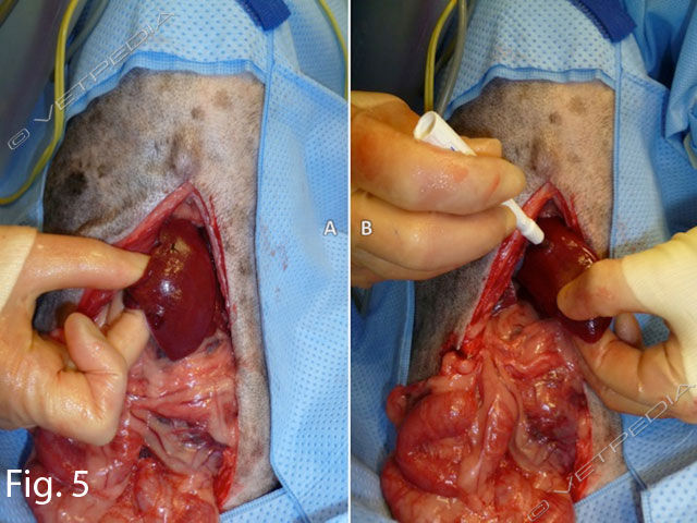 Biopsia con punch per lesioni situate nei lobi epatici