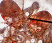 Neotrombicula autumnalis visibile al microscopio dopo scotch test