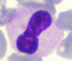 Granulocita neutrofilo iposegmentato in uno striscio di sangue di un Pastore australiano affetto da anomalia di Pelger Huet