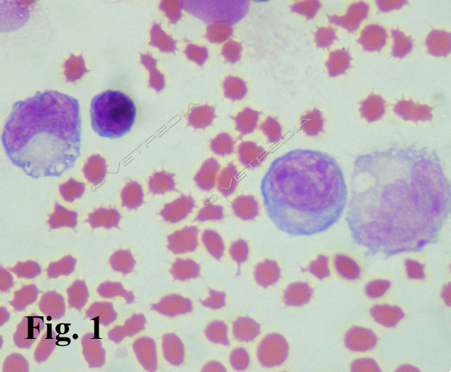 Trasudato modificato contenente una modica quantità di eritrociti tra i quali si rilevano macrofagi 