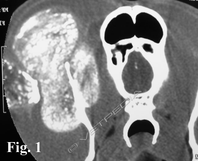 Immagine TAC di tumore multilobulare dell’osso col caratteristico aspetto di massa a “popcorn”.