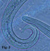 Aelurostrongylus abstrusus: particolare delle estremità anteriore e posteriore della larva di primo stadio
