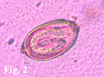 Uovo larvato infestante di Capillaria aerophila