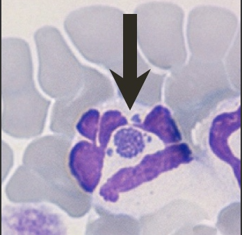 Morula di Anaplasma Phagocytophilum