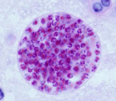 La manifestazione clinica della toxoplasmosi può variare notevolmente in relazione al grado e alla diffusione dell'infezione