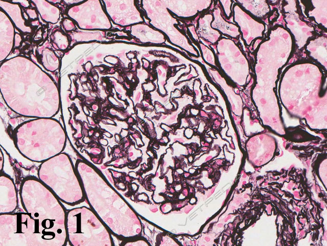 Glomerulonefrite membranosa in un cane 