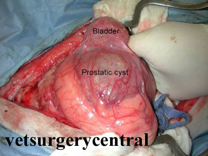 Le cisti paraprostatiche sono uno o più larghi sacchi di fluido che si rinvengono vicino alla prostata