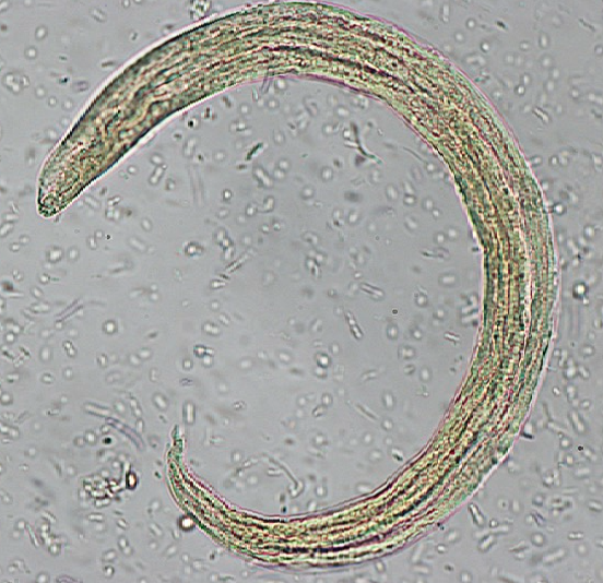 Larve di primo stadio di Angiostrongylus vasorum.