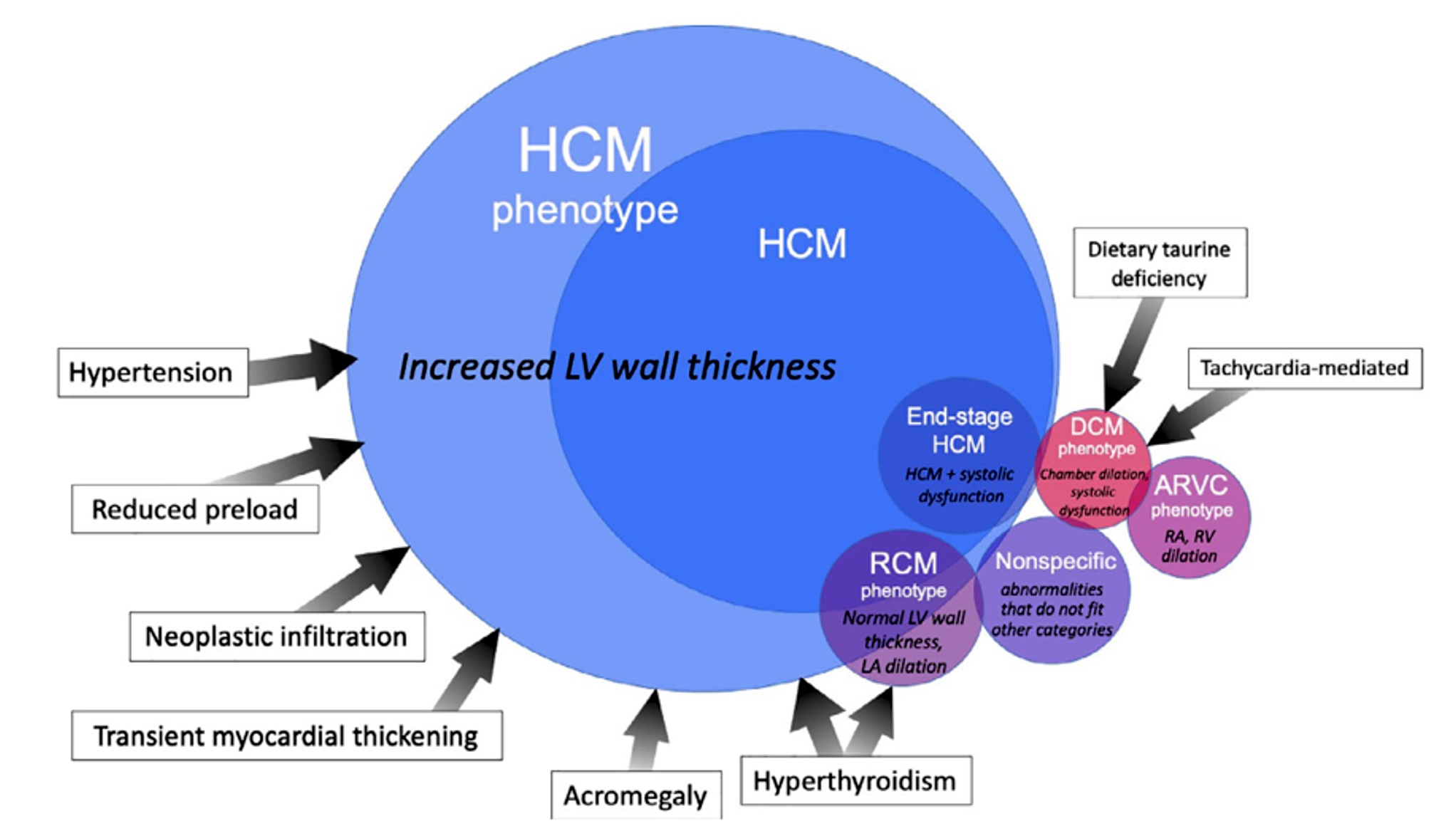 HCM in forma ostruttiva caratterizzata da stenosi dinamica del tratto di efflusso del ventricolo sinistro