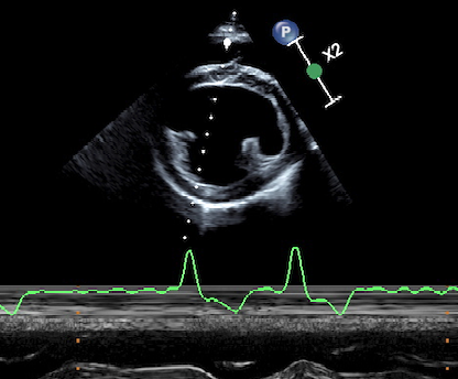 Fibrillazione atriale nel cane