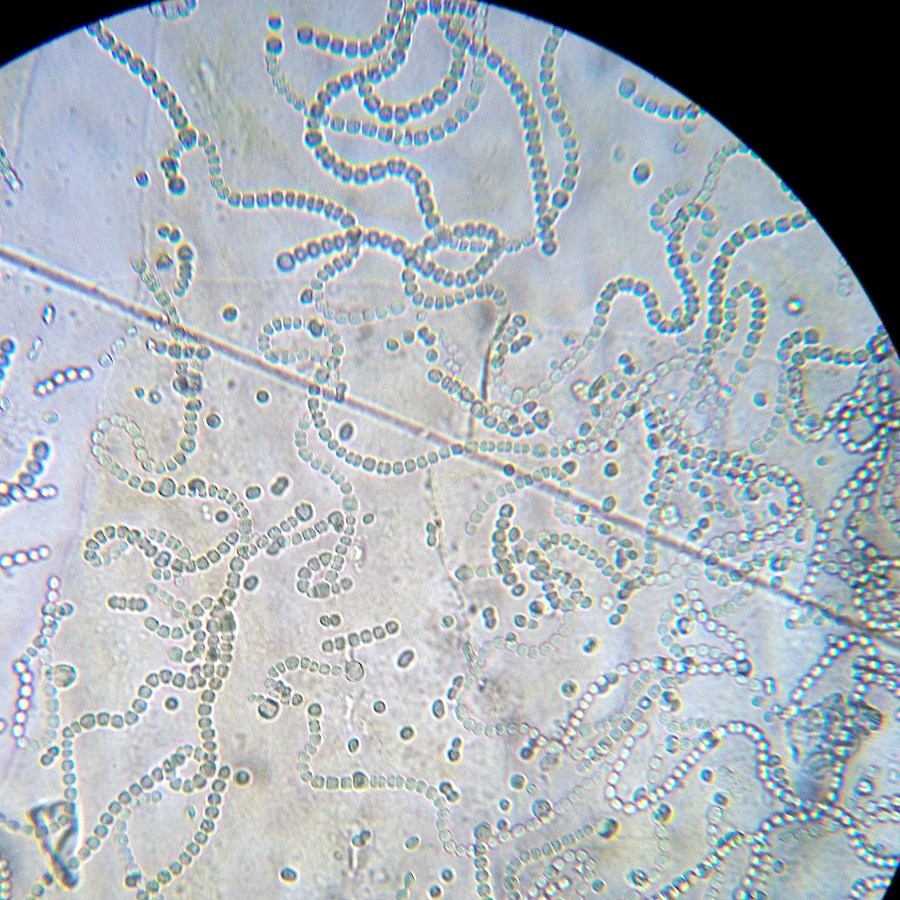 Intossicazione da cianotossine nel cane