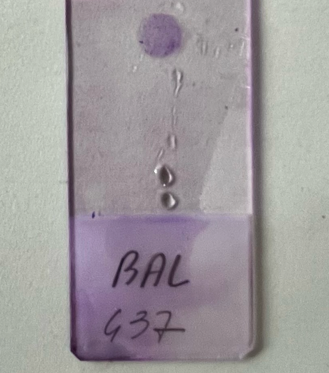 Esame del lavaggio bronco-alveolare del cane e del gatto