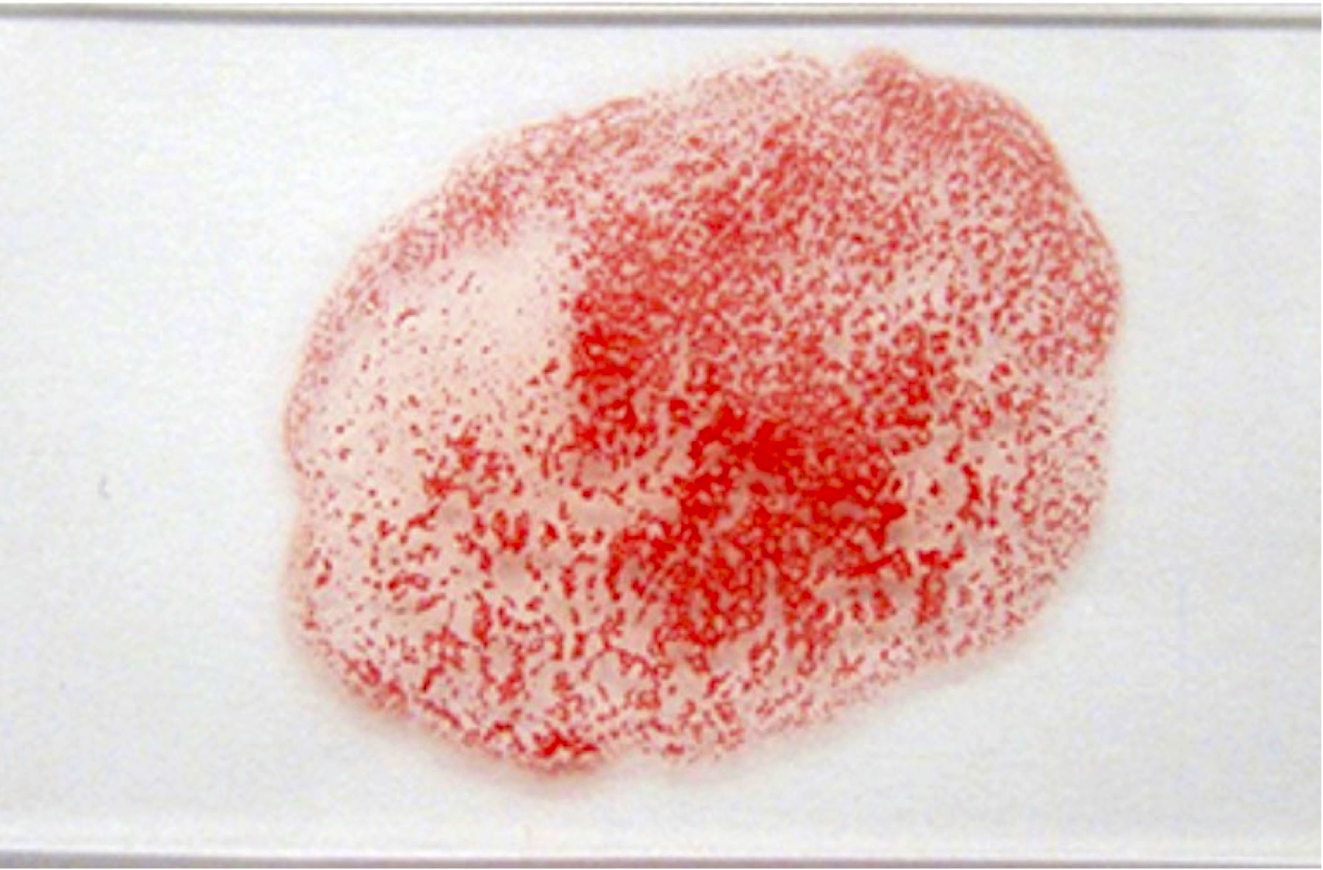 Prove di emocompatibilità nel cane nel gatto