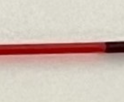 Reazioni trasfusionali