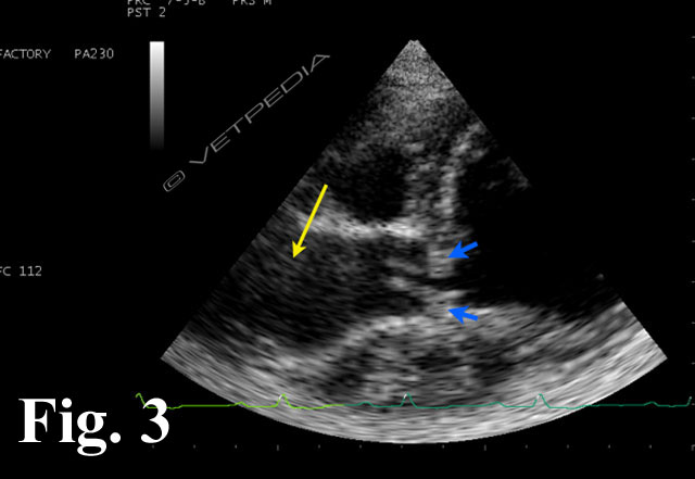 Stenosi subaortica del cane