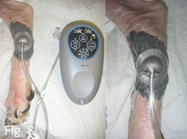 VAC (Vacuum Assisted Closure): principi di utilizzo nelle ferite complicate