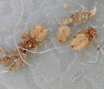 Pediculosi