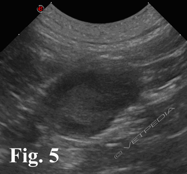 Esame ecografico dei linfonodi addominali