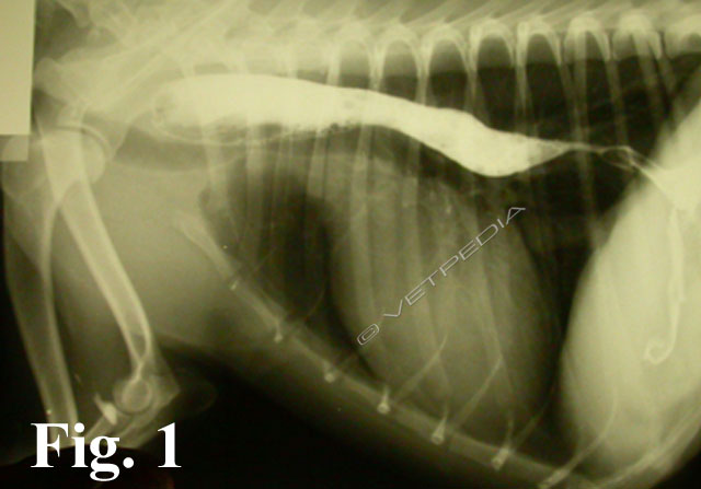 Fig. 1. Stenosi esofagea: è visibile il restringimento al passaggio di bario  in porzione esofagea precordiale.  