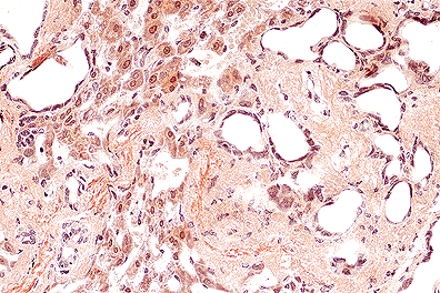 Patologie del criceto anziano