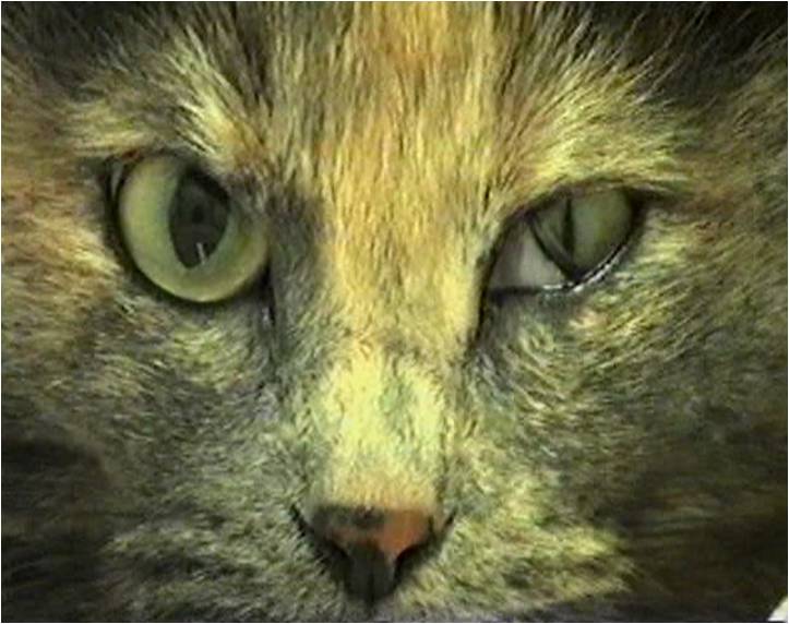 Sindrome vestibolare