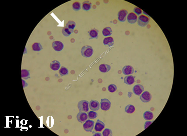 Esame del liquido cerebrospinale