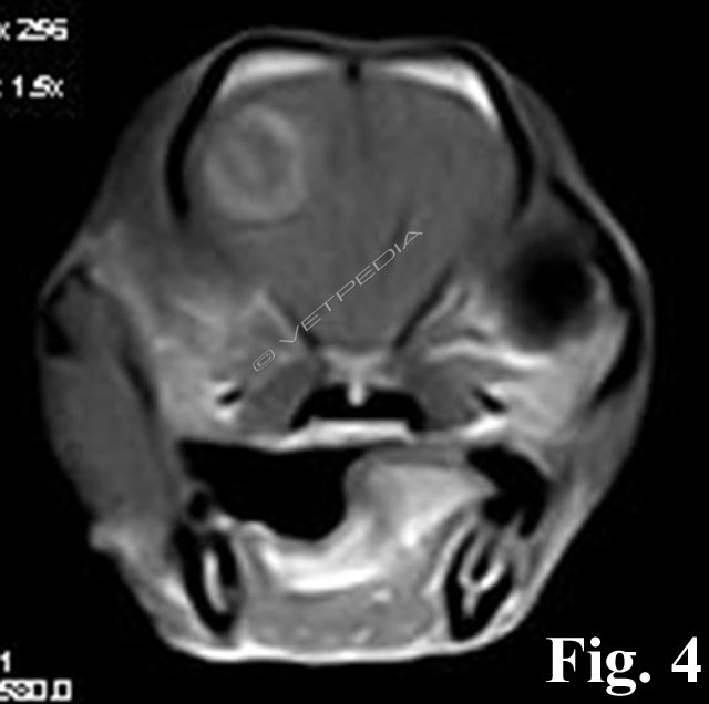 Immagine T1-W post-contrasto di una sezione trasversa di encefalo di cane affetto da GME focale. 