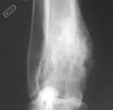Osteosarcoma del cane e del gatto