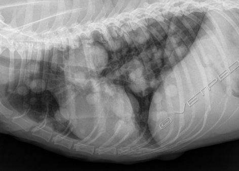 Stadiazione clinica dei tumori