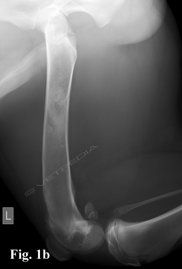 Panosteite (enostosi, panosteite eosinofilica)