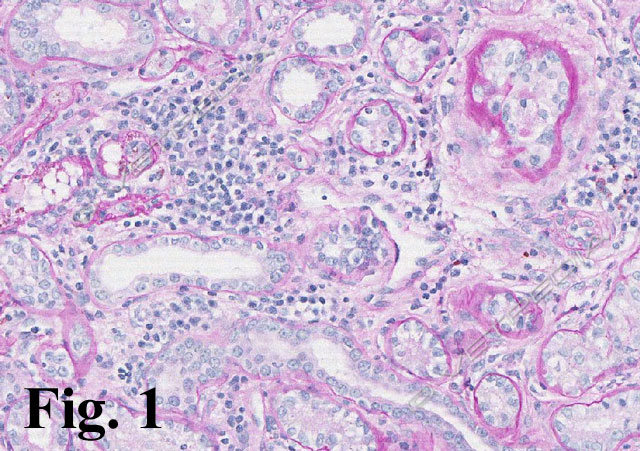 Nefrite interstiziale e necrosi tubulare acuta nel cane e nel gatto